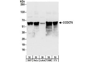 anti-Coiled-Coil Domain Containing 76 (CCDC76) (AA 25-75) antibody