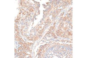 Immunohistochemistry of paraffin-embedded rat ovary using KIF14 antibody (ABIN6129691, ABIN6142854, ABIN6142855 and ABIN6214465) at dilution of 1:100 (40x lens). (KIF14 抗体  (AA 1399-1648))