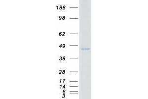 Western Blotting (WB) image for Protein Kinase, X-Linked (PRKX) protein (Myc-DYKDDDDK Tag) (ABIN2729647)