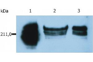 Western Blotting analysis of whole cell lysate of HUT-78 human cutaneous T cell lymphoma cell line. (CD45RA 抗体  (FITC))