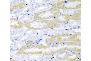 Immunohistochemistry of paraffin-embedded Mouse kidney using FABP6 Polyclonal Antibody at dilution of 1:200 (40x lens). (FABP6 抗体)