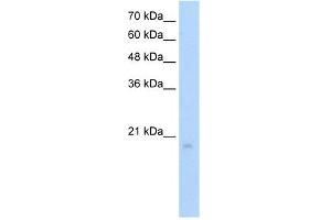 WB Suggested Anti-RGS8 Antibody Titration:  5. (RGS8 抗体  (N-Term))
