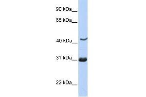 WB Suggested Anti-NUP35 Antibody Titration: 0. (NUP35 抗体  (C-Term))