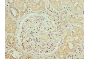 Immunohistochemistry of paraffin-embedded human kidney tissue using ABIN7145914 at dilution of 1:100 (CCR1 抗体  (AA 306-355))