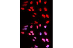Immunofluorescence analysis of U2OS cells using PRPF3 antibody.