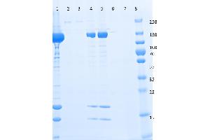 SDS-PAGE of Anti-DYKDDDDK  Affinity Gel. (DYKDDDDK Tag 抗体  (Agarose Beads))