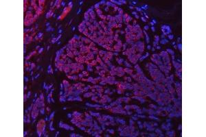 IF analysis of SETD3 using anti-SETD3 antibody (ABIN7600293).