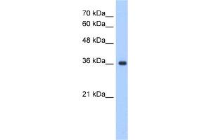 WB Suggested Anti-ELOVL7 Antibody Titration:  1. (ELOVL7 抗体  (N-Term))