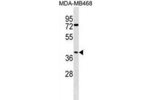 Western Blotting (WB) image for anti-Abhydrolase Domain Containing 1 (ABHD1) antibody (ABIN3000271) (ABHD1 抗体)