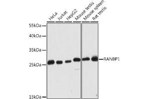 Western blot analysis of extracts of various cell lines, using R Rabbit pAb (ABIN7269841) at 1:2000 dilution. (RANBP1 抗体  (AA 1-100))
