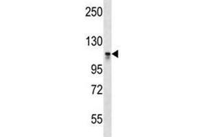 Western Blotting (WB) image for anti-DNA (Cytosine-5-)-Methyltransferase 3 alpha (DNMT3A) (AA 872-900) antibody (ABIN3030747)