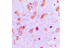 Immunohistochemical analysis of Cytokeratin 13 staining in human brain formalin fixed paraffin embedded tissue section. (Cytokeratin 13 抗体  (Center))
