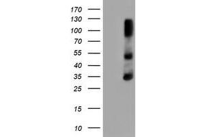 HEK293T cells were transfected with the pCMV6-ENTRY control (Left lane) or pCMV6-ENTRY ERCC1 (Right lane) cDNA for 48 hrs and lysed. (ERCC1 抗体)