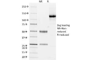 SDS-PAGE Analysis Purified Cytokeratin 10/13 Monoclonal Antibody (DE-K13). (KRT10, KRT13 抗体)