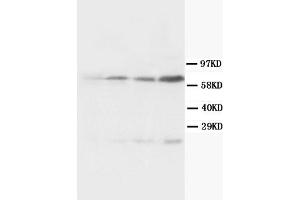 Western Blotting (WB) image for anti-Bridging Integrator 1 (BIN1) (AA 189-398) antibody (ABIN1105531) (BIN1 抗体  (AA 189-398))