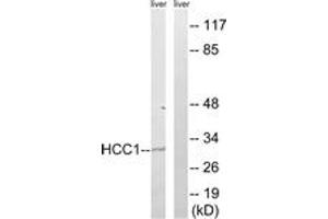 Western blot analysis of extracts from mouse liver cells, using HCC1 Antibody.