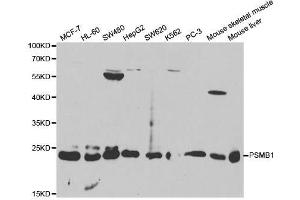 Western blot analysis of extracts of various cell lines, using PSMB1 antibody. (PSMB1 抗体  (AA 29-241))