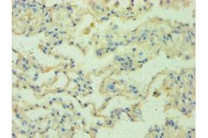 Immunohistochemistry of paraffin-embedded human lung tissue using ABIN7168147 at dilution 1:100 (RRM2B 抗体  (AA 1-351))