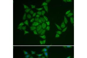 Immunofluorescence analysis of HeLa cells using AMPD3 Polyclonal Antibody (AMPD3 抗体)