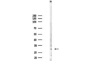 Western blot analysis of lysates from K562 cells(heat-shock 45 min treatment), using DNase I Antibody at 1/1000 dilution.