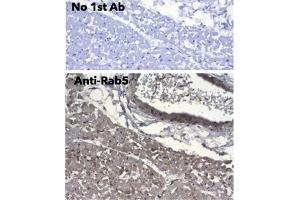 Immunohistochemistry (IHC) image for anti-RAB5A, Member RAS Oncogene Family (RAB5A) (C-Term) antibody (ABIN1440056) (RAB5 抗体  (C-Term))