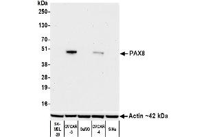 Western Blotting (WB) image for anti-Paired Box 8 (PAX8) antibody (ABIN7795603)
