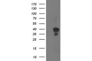 Western Blotting (WB) image for anti-NudE Nuclear Distribution E Homolog (A. Nidulans)-Like 1 (NDEL1) antibody (ABIN1499854) (NDEL1 抗体)