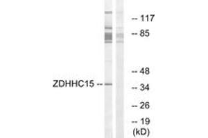 Western blot analysis of extracts from Jurkat cells, using ZDHHC15 Antibody. (ZDHHC15 抗体  (AA 288-337))