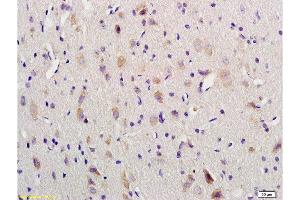 Formalin-fixed and paraffin embedded rat brain labeled with Anti-VIP Polyclonal Antibody, Unconjugated  1:200 followed by conjugation to the secondary antibody and DAB staining (Vip 抗体  (AA 125-152))