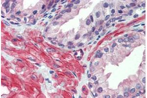 Human Prostate: Formalin-Fixed, Paraffin-Embedded (FFPE) (HTR2C 抗体  (AA 387-446))