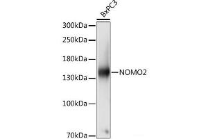 Western blot analysis of extracts of BxPC3 cells using NOMO2 Polyclonal Antibody at dilution of 1:1000. (NOMO2 抗体)