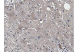 Detection of CNPY2 in Human Liver Tissue using Polyclonal Antibody to Canopy 2 Homolog (CNPY2) (CNPY2/MSAP 抗体  (AA 21-182))