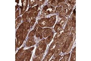 Immunohistochemical staining of human stomach with TBC1D24 polyclonal antibody  shows strong cytoplasmic positivity in glandular cells at 1:200-1:500 dilution.