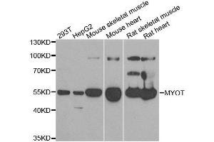 Western blot analysis of extracts of various cell lines, using MYOT antibody. (Myotilin 抗体)