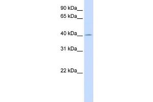 WB Suggested Anti-ACAA2 Antibody Titration:  0. (ACAA2 抗体  (N-Term))