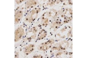 Immunohistochemistry of paraffin-embedded human stomach using KPNA4 Antibody (ABIN5971058) at dilution of 1/200 (40x lens). (KPNA4 抗体)