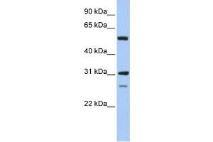 IMPDH1 antibody used at 1 ug/ml to detect target protein.