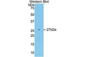 Western blot analysis of the recombinant protein. (Neuregulin 1 抗体  (AA 20-242))