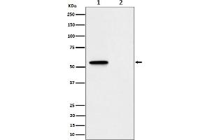 Western blot analysis of Phospho-MLKL (S345) expression in (1) L929 treated with Z-VAD + TNF alpha + SM164 cell lysate, (2) Untreated.
