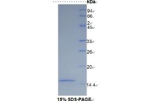 SDS-PAGE (SDS) image for Solute Carrier Family 30 (Zinc Transporter), Member 8 (SLC30A8) ELISA Kit (ABIN6720588)