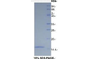 SDS-PAGE of Protein Standard from the Kit (Highly purified E. (SLC30A8 ELISA 试剂盒)