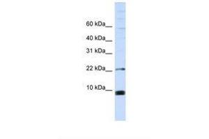 Image no. 1 for anti-Small Nuclear Ribonucleoprotein Polypeptide F (SNRPF) (C-Term) antibody (ABIN6737923)