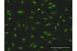 Immunofluorescence (IF) image for anti-SWI/SNF Related, Matrix Associated, Actin Dependent Regulator of Chromatin, Subfamily A, Member 5 (SMARCA5) (AA 1-1052) antibody (ABIN521925)