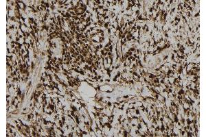 ABIN6276940 at 1/100 staining Human gastric tissue by IHC-P. (LIG3 抗体  (Internal Region))