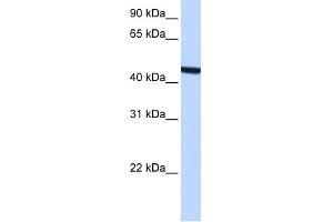 WB Suggested Anti-ZCCHC3 Antibody Titration:  0. (ZCCHC3 抗体  (Middle Region))