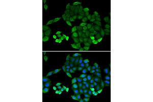 Immunofluorescence analysis of MCF-7 cells using PTS antibody (ABIN5973727). (PTS 抗体)