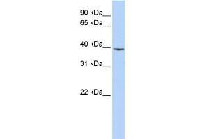 WB Suggested Anti-H2AFY Antibody Titration: 0. (H2AFY 抗体  (N-Term))