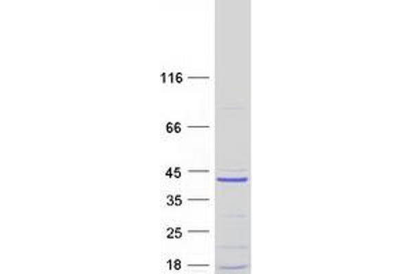 C11ORF74 Protein (Myc-DYKDDDDK Tag)