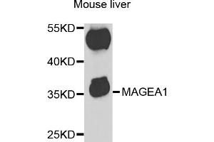 Western blot analysis of extracts of mouse liver, using MAGEA1 antibody (ABIN5973183) at 1/1000 dilution. (MAGEA1 抗体)