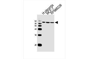 Lane 1: Sample Tissue/Cell lysates, Lane 2: Sample Tissue/Cell lysates, Lane 3: Sample Tissue/Cell lysates, probed with antibodyname Monoclonal Antibody, unconjugated (bsm-51388M) at 1:1000 overnight at 4°C followed by a conjugated secondary antibody for 60 minutes at 37°C. (RPS6KB2 抗体)